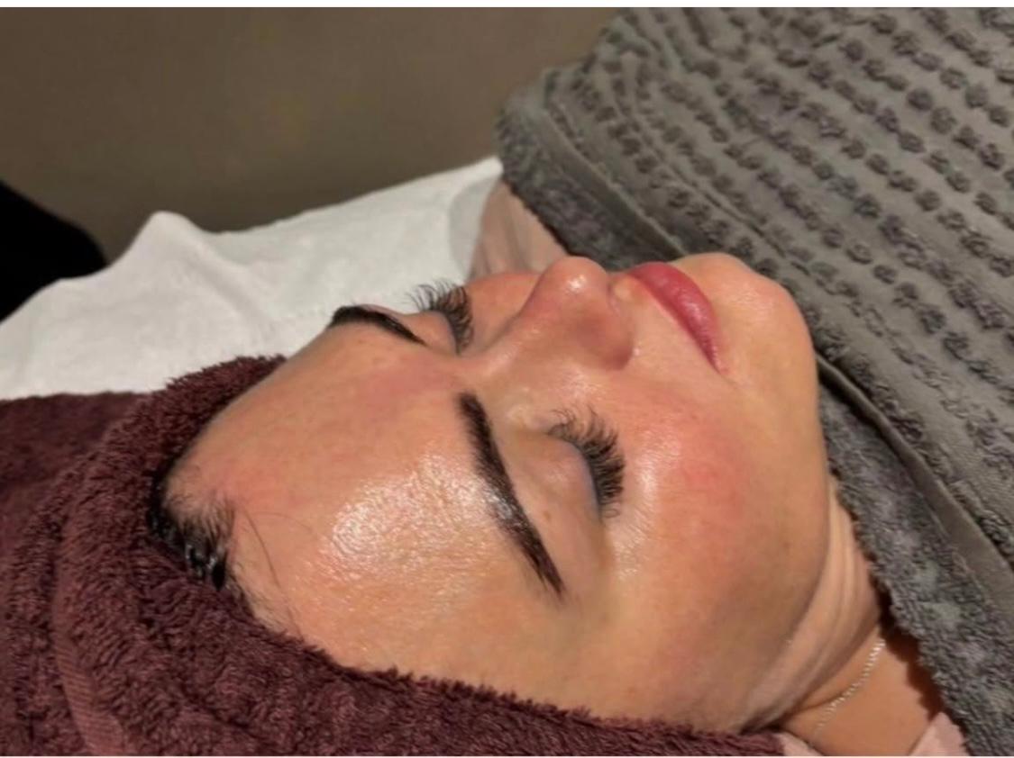 Million Dollar Immaculate Peels