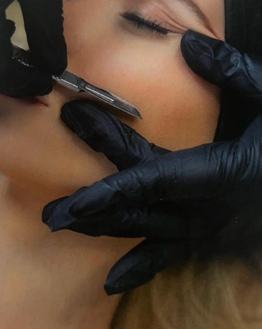 Million Dollar Dermaplaning