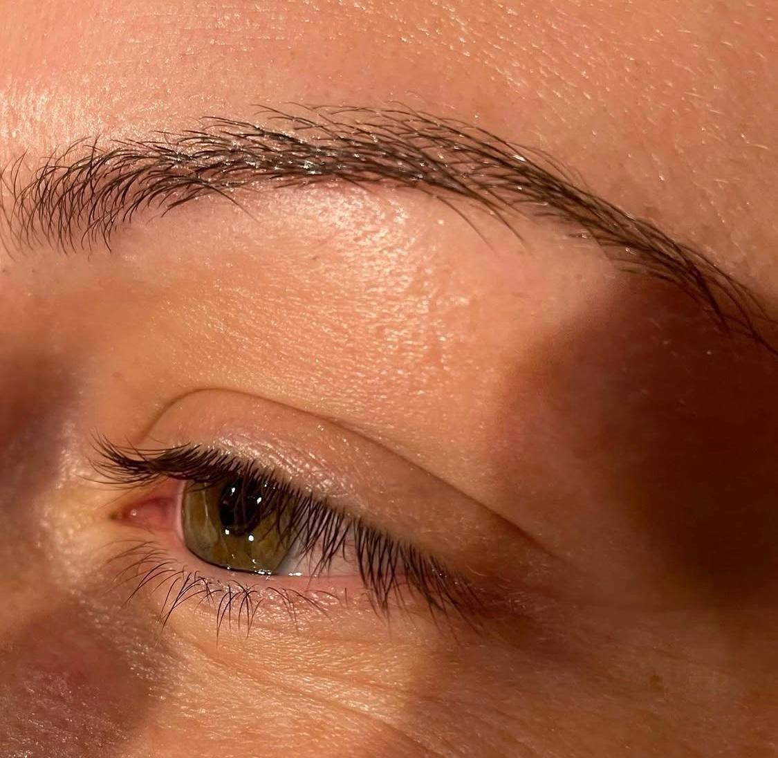 Standard Eye Treatments